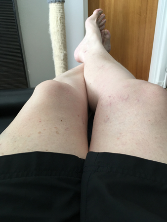 Mina bleka ben i svarta shorts