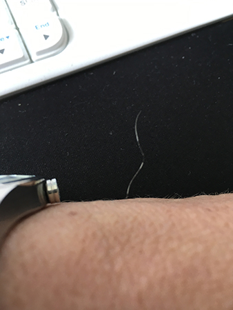 Hårstrå på handleden