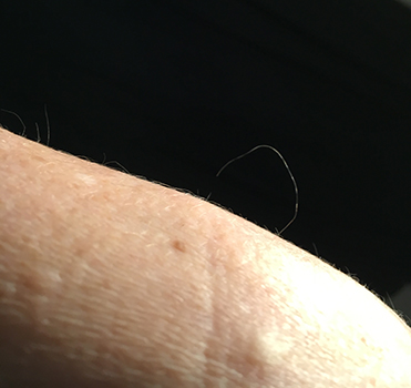 Hårstrå på handleden