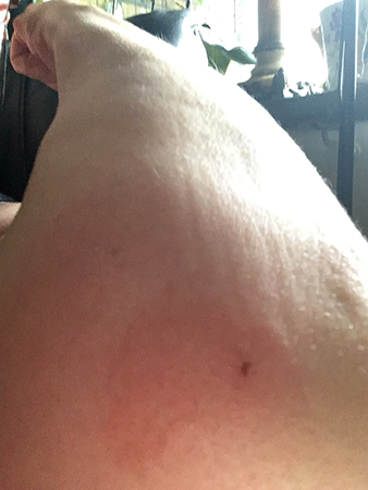 Bettet och armbågen tisdag kväll