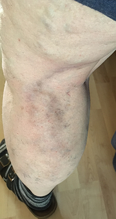 Proppen måndag kväll 23 mars 2020