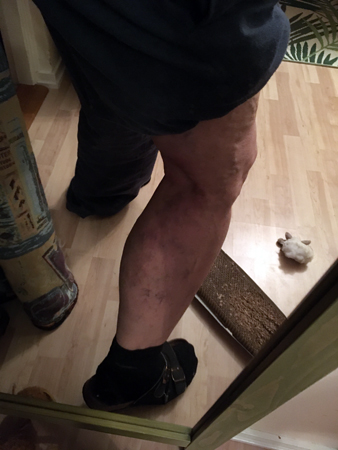 Världens fulaste ben