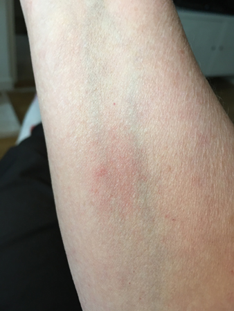 Bett eller stick 12 maj