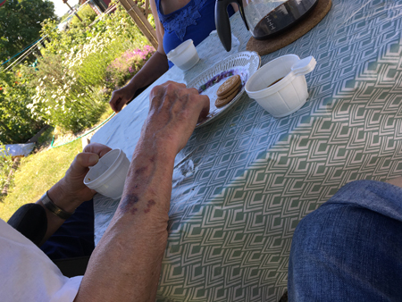 Fika i Slottsträdgården