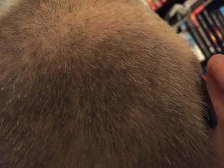 Nyrakat bakhuvud nov 2020