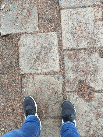 Gympadojor jeansben och barnmark