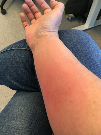 Stickarmen tisdag em