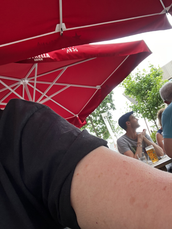 Är armen inte lite solbränd