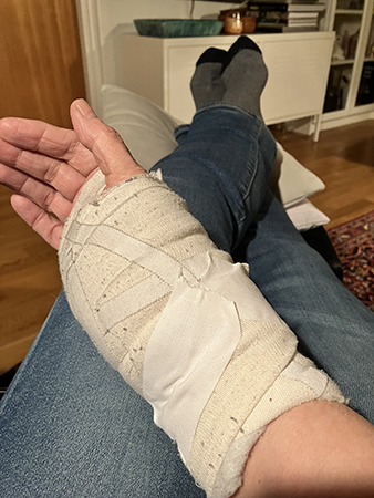 Handen i bandage 21 feb 2023