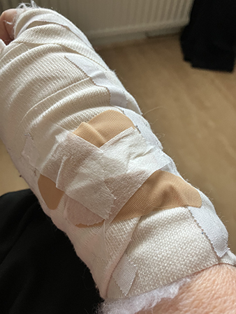 Plåster på bandaget