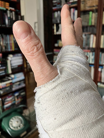 Rörliga fingrar på svag hand