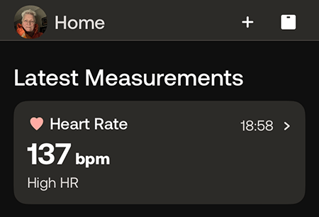 Hög hjärtrytm 137 slag i minuten