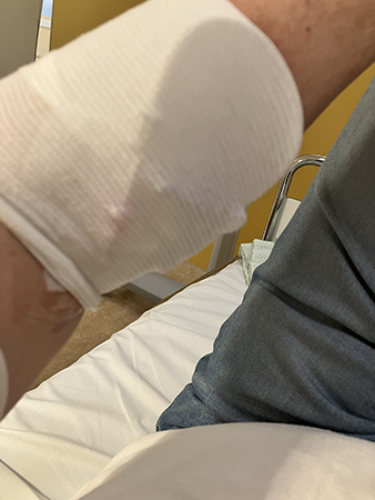 Infart i vänster armveck