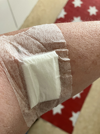 Provtagen och kirurgtejp i armvecket