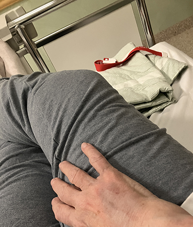 Handen börjar bli blå efter stickförsök Handen börjar bli blå efter stickförsök