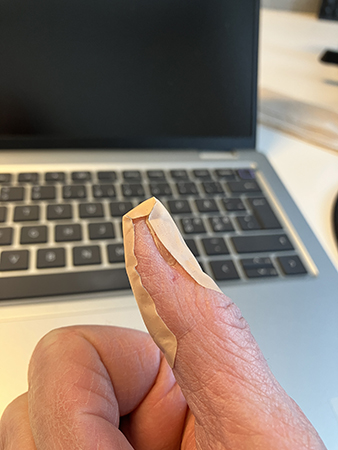 Plåster på tummen