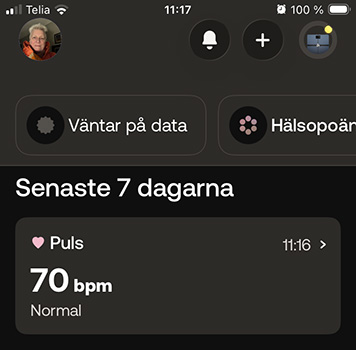 Puls 70